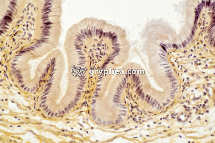 Oesophage Chien x100 - gryphea.org